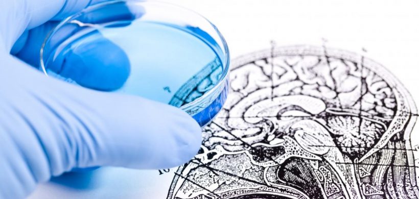 Colecciones CREA: «Artículos de investigación sobre alzhéimer»