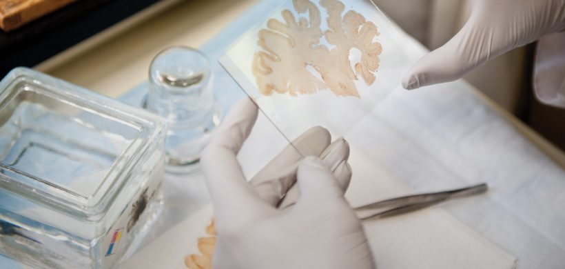 La investigación a partir del Banco de Tejidos Neurológicos