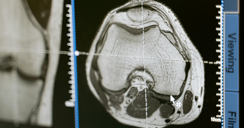 Resonancia magnetica y PET-FDG en la demencia frontotemporal variante conductual: revisión sistemática