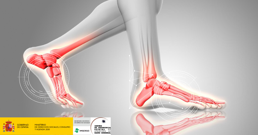 Implicaciones de la modularidad de un exoesqueleto superficial sobre las presiones plantares, la fuerza y la espasticidad en personas con daño cerebral adquirido